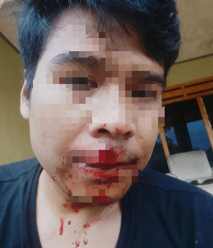 Pemilik perusahan media sidik berita.com cekcok berujung Pengeroyokan , Korban menuntut pelaku keranah hukum.